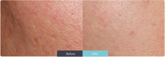 護(hù)膚小常識(1)-陳艷麗化妝品-董煥406