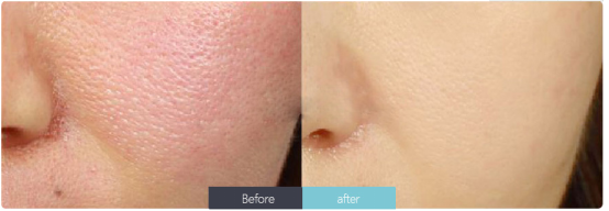 護(hù)膚小常識(1)-陳艷麗化妝品-董煥413